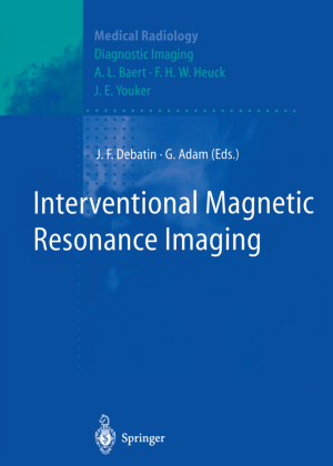Interventional Magnetic Resonance Imaging
