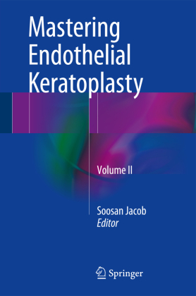 Mastering Endothelial Keratoplasty. Vol.2